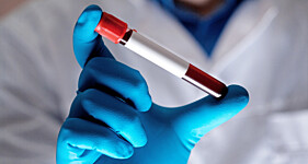 CREATININA E UREIA (Função Renal)