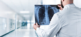 RADIOGRAFIA COLUNA DORSAL - 2 INCIDÊNCIAS