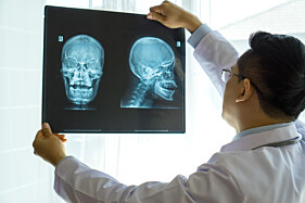 RADIOGRAFIA CRÂNIO - 4 INCIDÊNCIAS