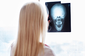 RADIOGRAFIA INCIDÊNCIA ADICIONAL DE CRÂNIO OU FACE