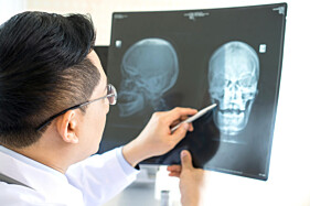 RADIOGRAFIA OSSOS DA FACE