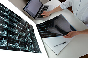 RESSONÂNCIA MAGNÉTICA COXA - UNILATERAL