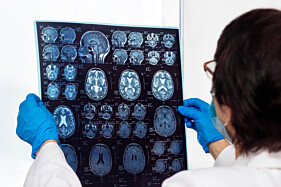 RESSONÂNCIA MAGNÉTICA FACE - INCLUI SEIOS DA FACE